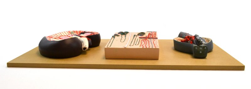 Life-Size Human Kidney Model, 3 Sections